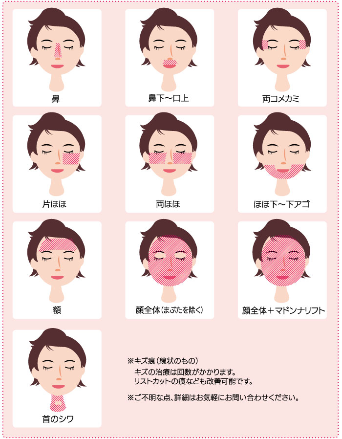 AdeBスマートサイトドット範囲