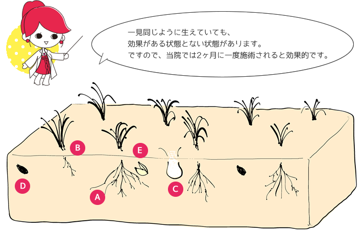 AdeB脱毛頻度