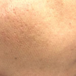 AdeBスマートサイドドット
