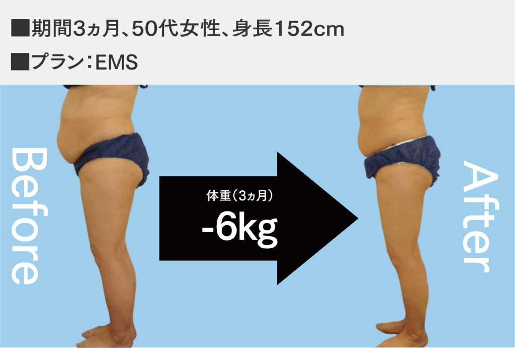 痩身症例01