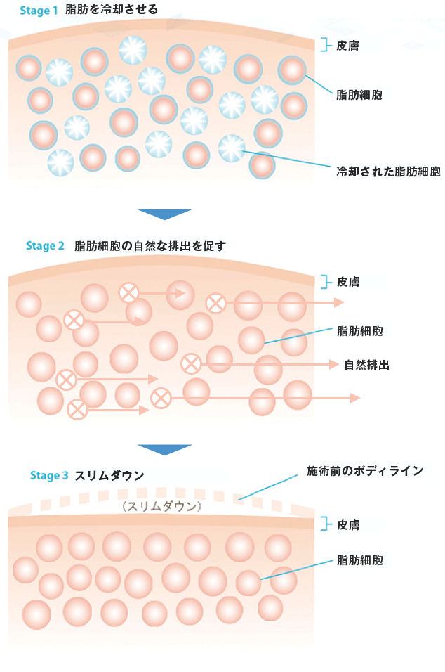 AdeBクールシェイピングのメカニズム