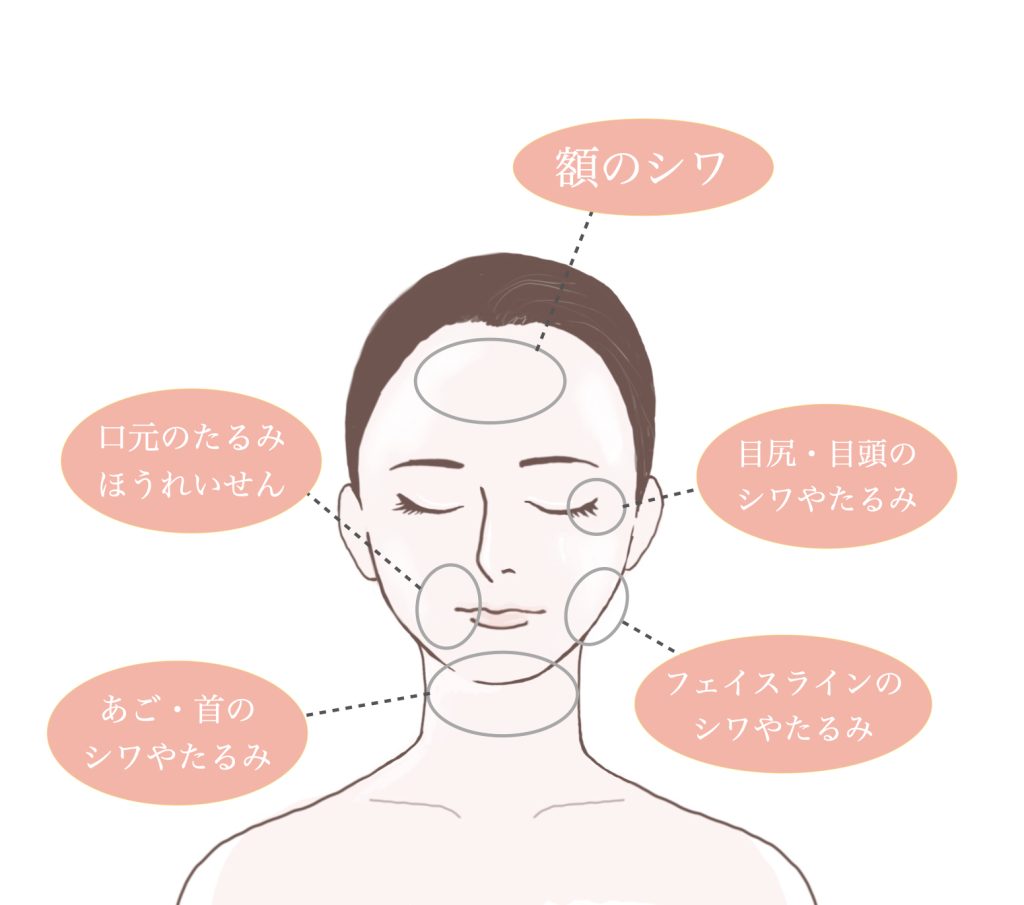 テノール効果