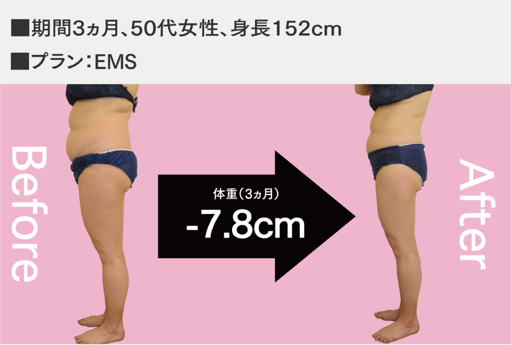 痩身症例02