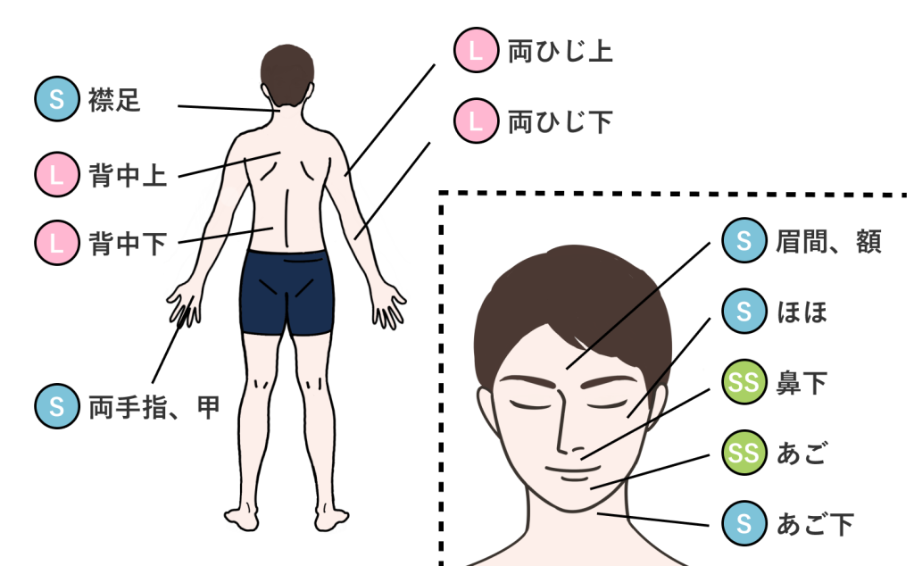 男性脱毛パーツ背面顔面