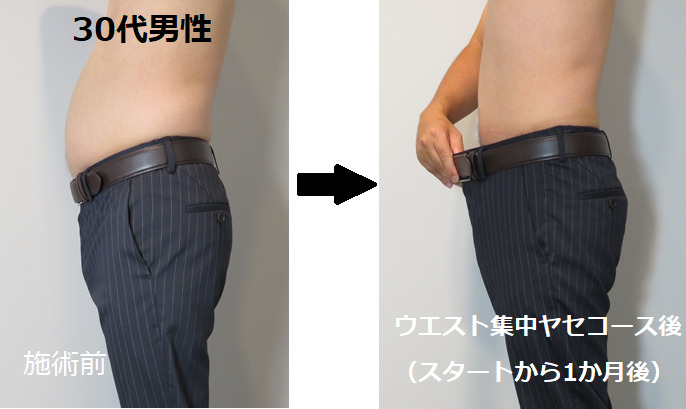 ウエスト集中ヤセコース