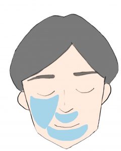 男性顔 髭 脱毛 秋田市の美容皮膚科 Adebクリニック