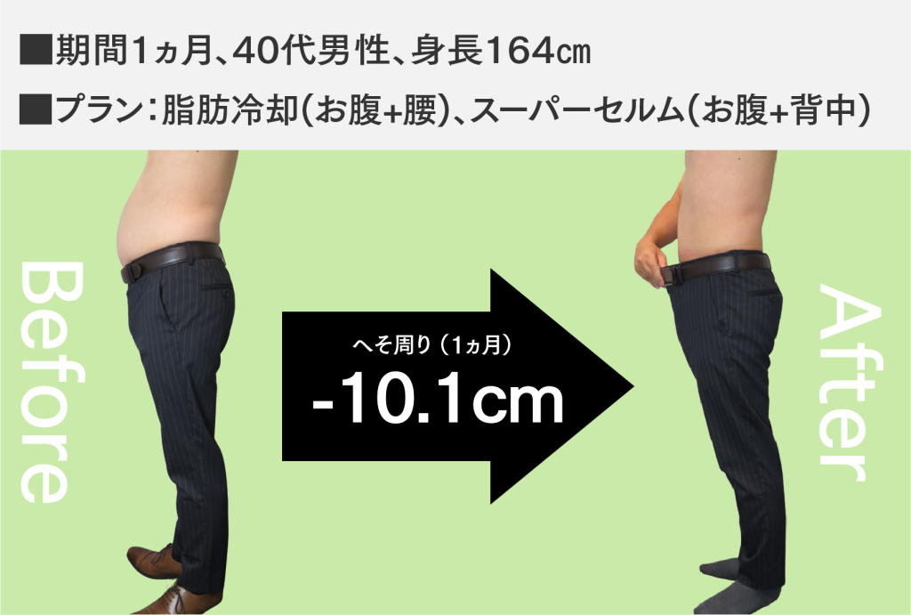 脂肪冷却事例