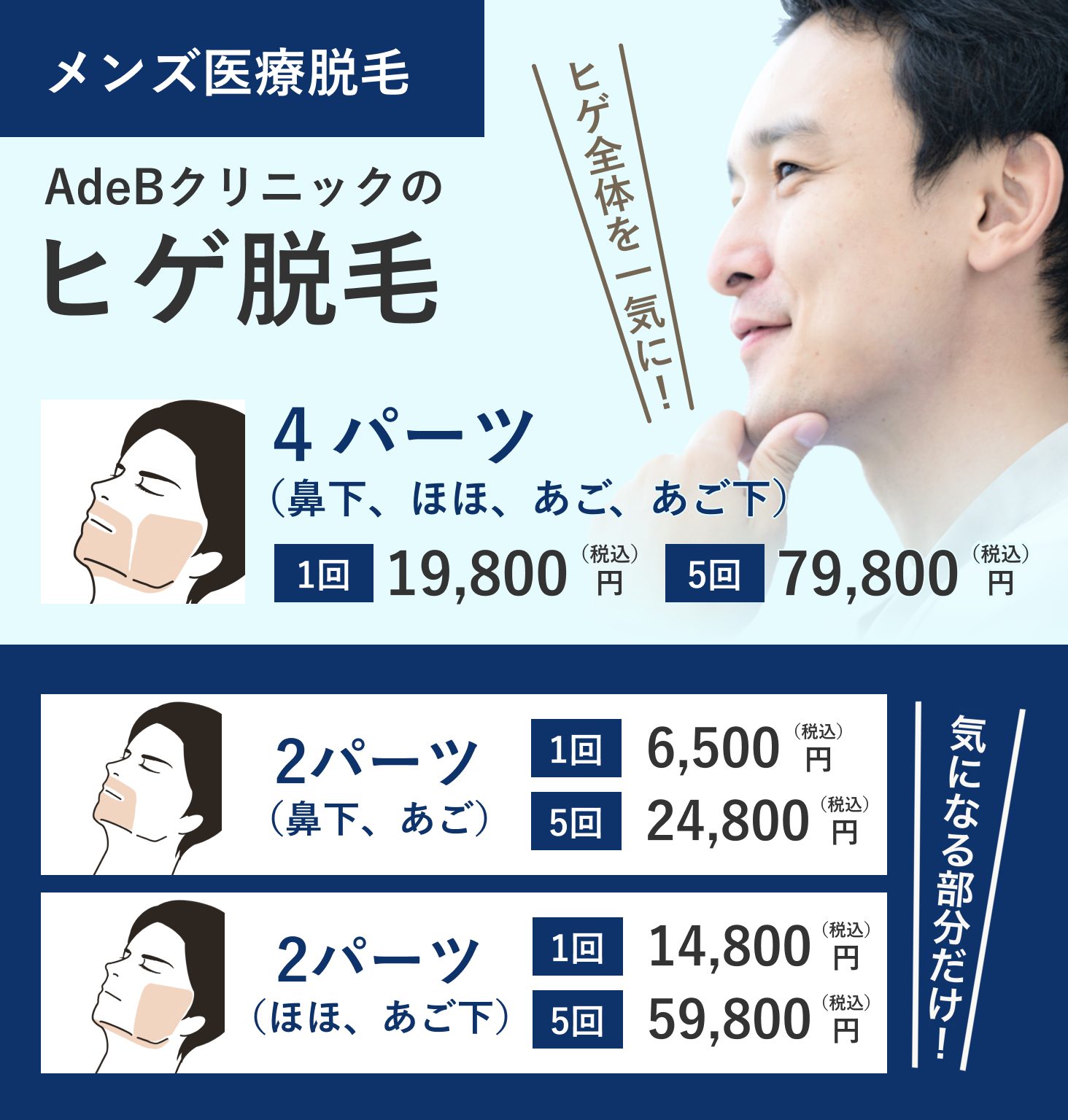 メンズヒゲ脱毛 - 秋田市の美容皮膚科 AdeBクリニック