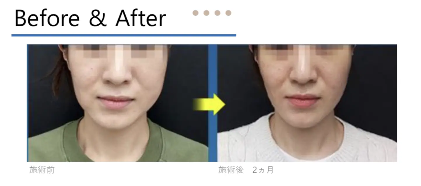 テノールネオの症例写真１