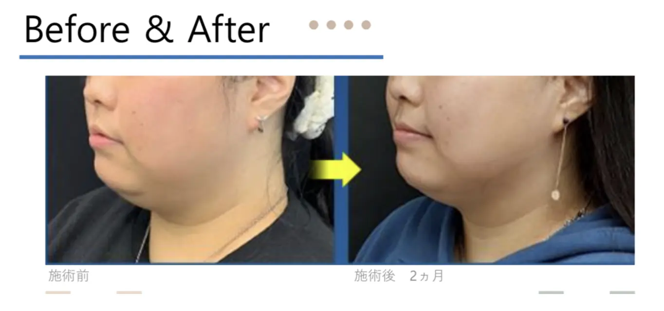 テノールネオの症例写真2