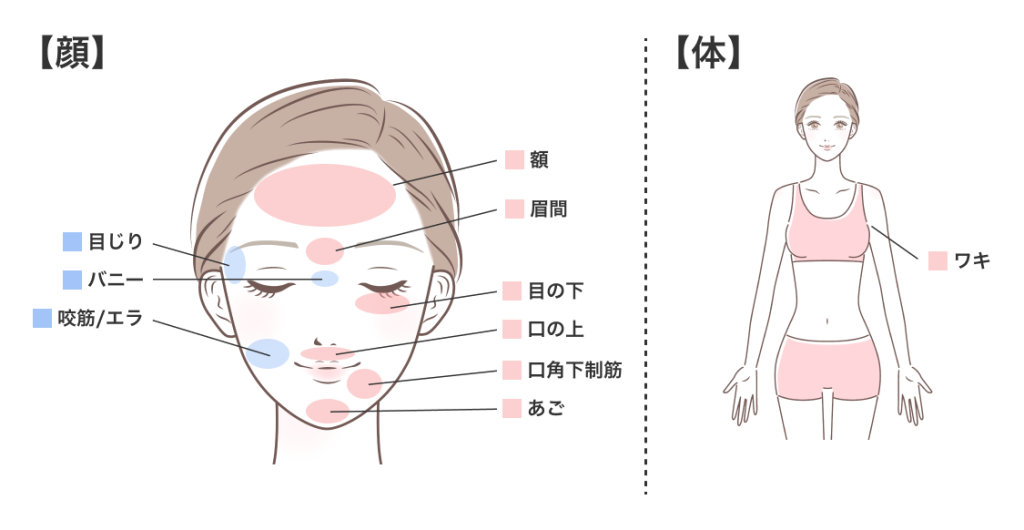 ボトックス 部位