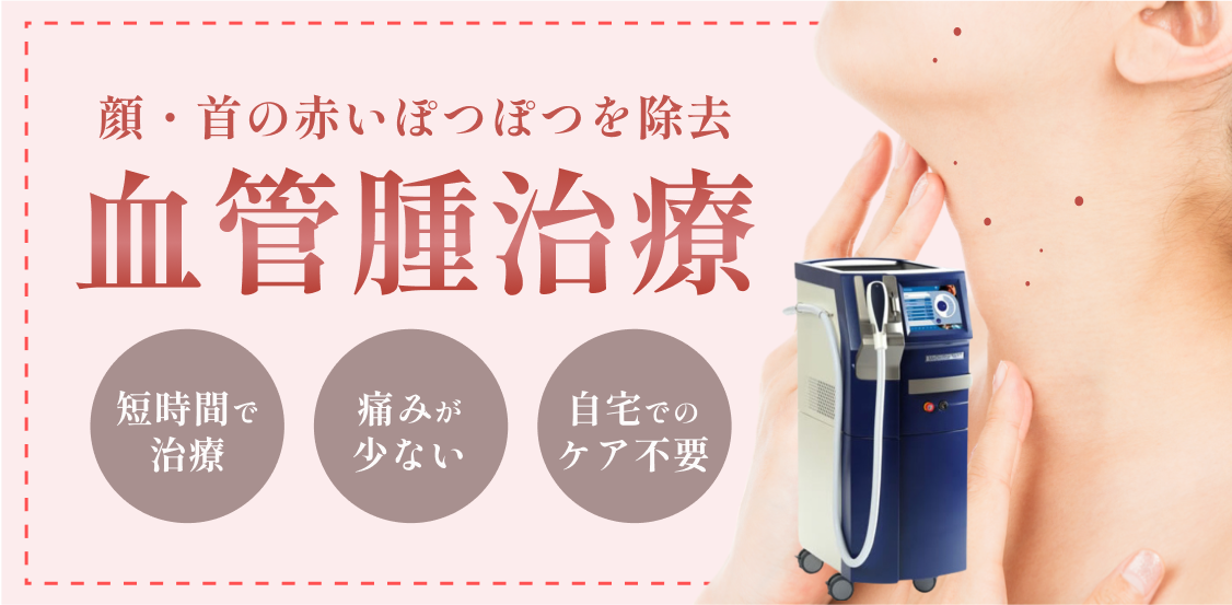 秋田院_血管腫治療_アイキャッチ