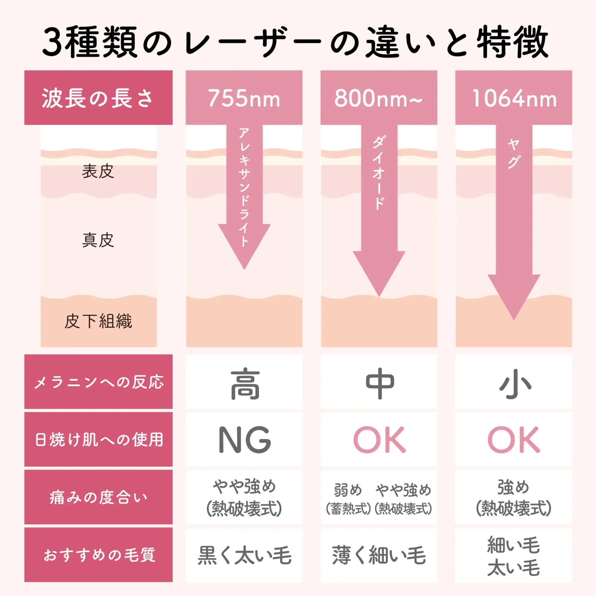 千葉で全身脱毛するなら！医療脱毛クリニックおすすめ9選