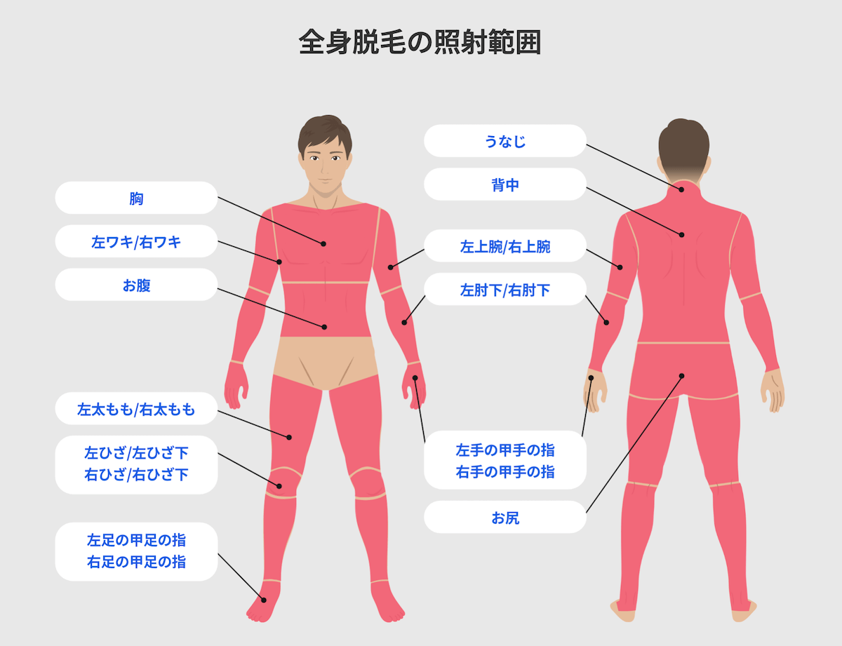 全身脱毛照射部位
