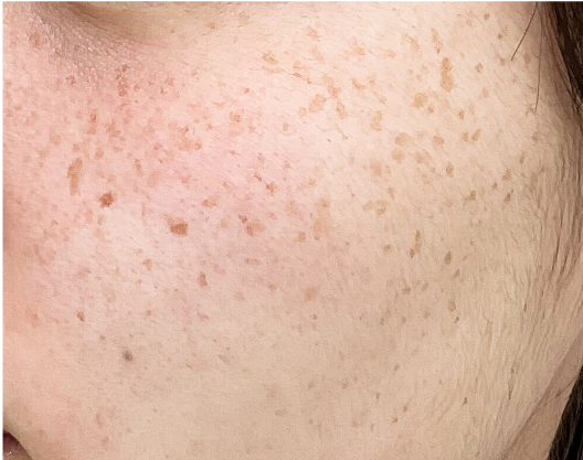 babb43ee241f067193237031b303a8