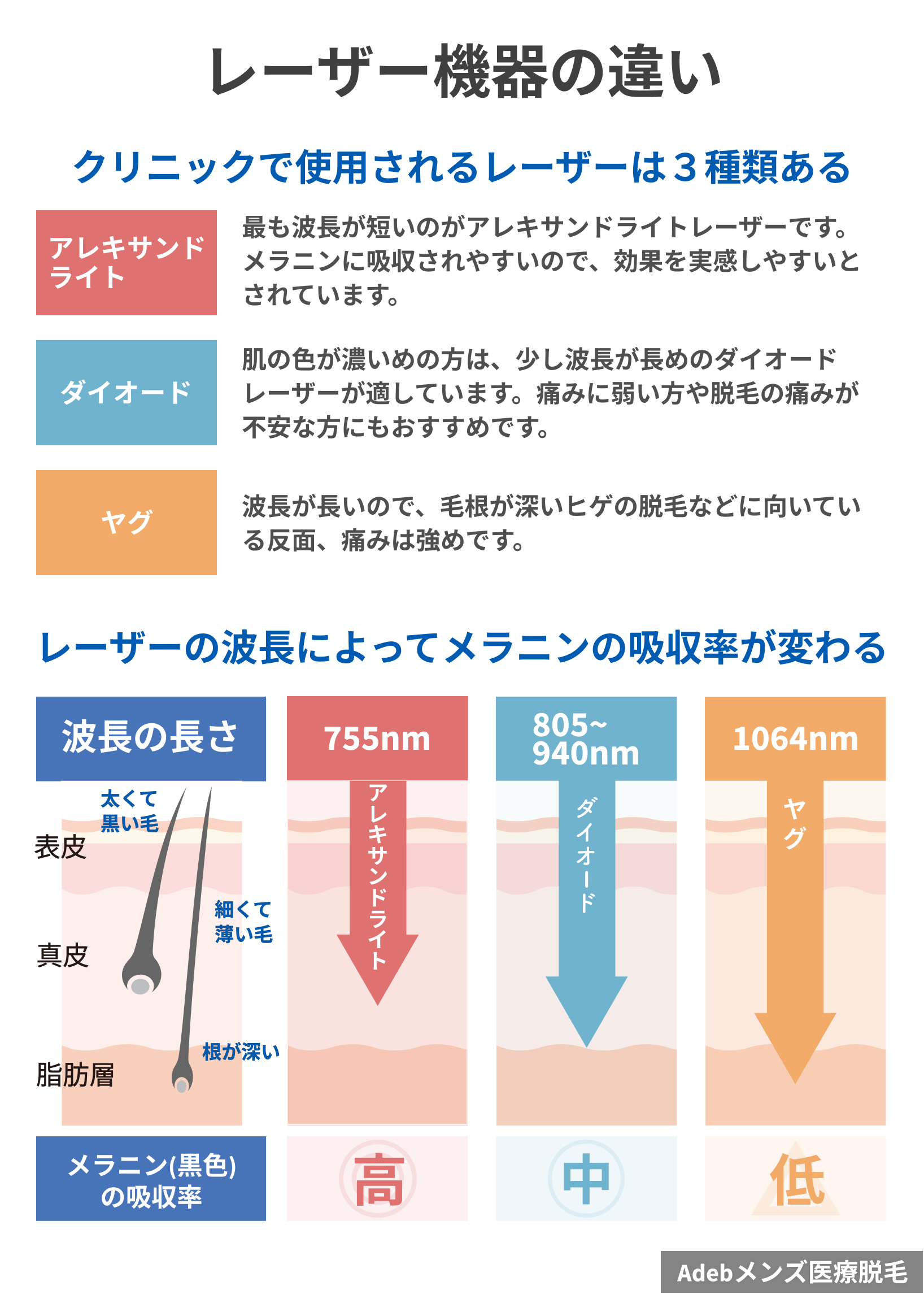 脱毛レーザーの種類で選ぶ