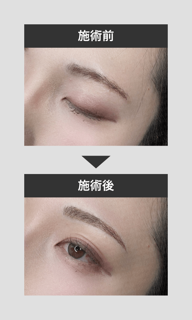 アートメイク（眉・アイライン・唇・ヘアライン） - 秋田市の美容皮膚