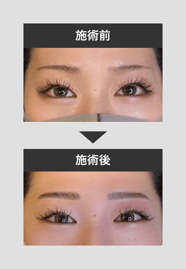 アートメイク_眉_5