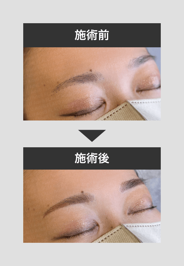 アートメイク（眉・アイライン・唇・ヘアライン） - 秋田市の美容皮膚