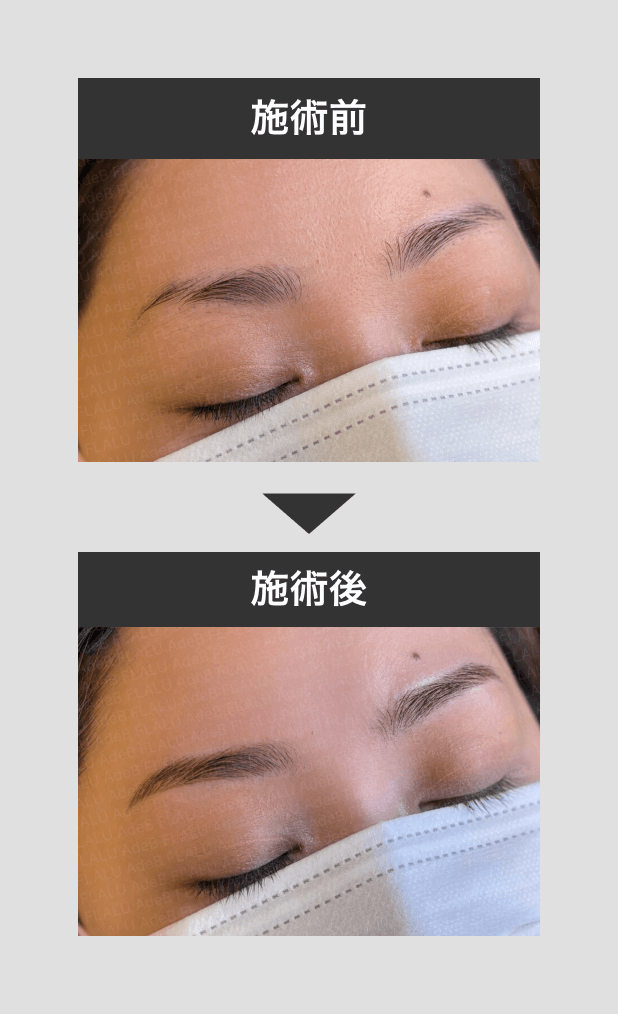 アートメイク_眉_7