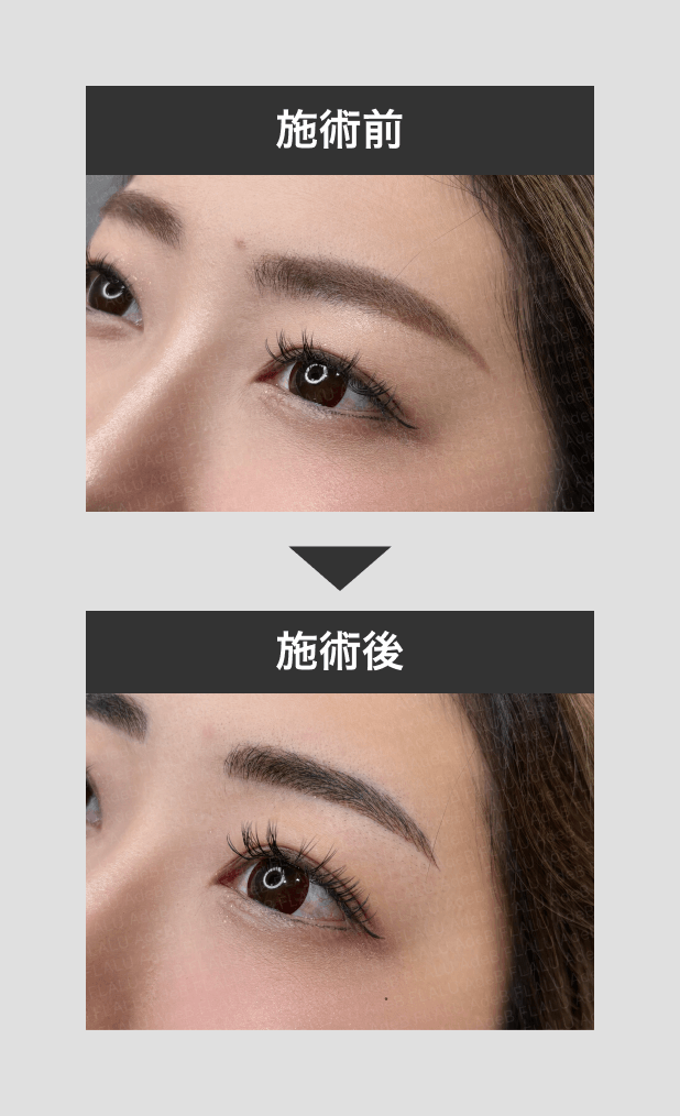 アートメイク_眉_4