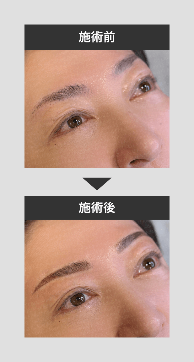 アートメイク_眉_3