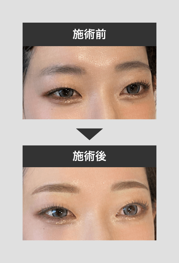 アートメイク_眉_1