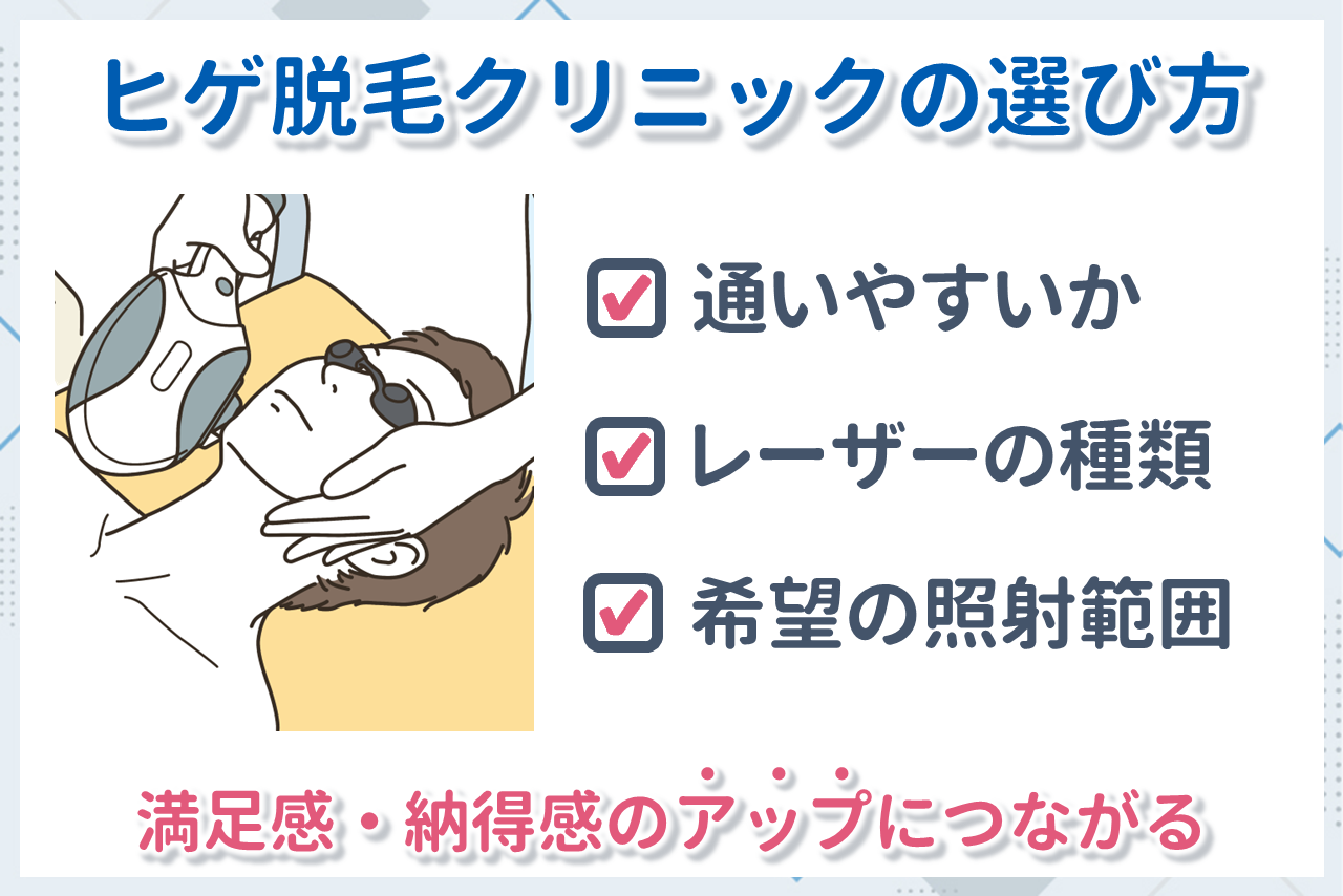 メンズヒゲ脱毛の選び方