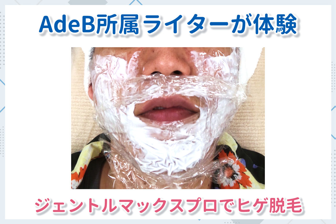 ヒゲ脱毛の体験談
