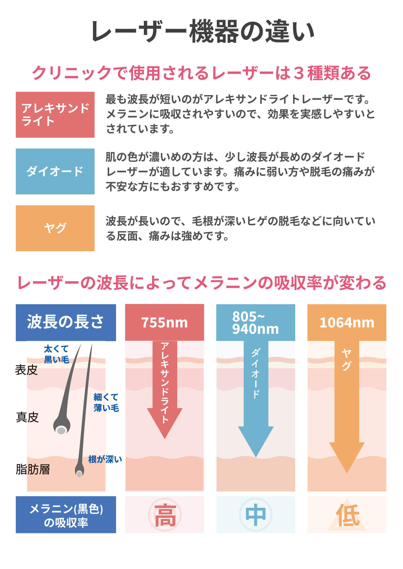 医療脱毛 レーザーの種類