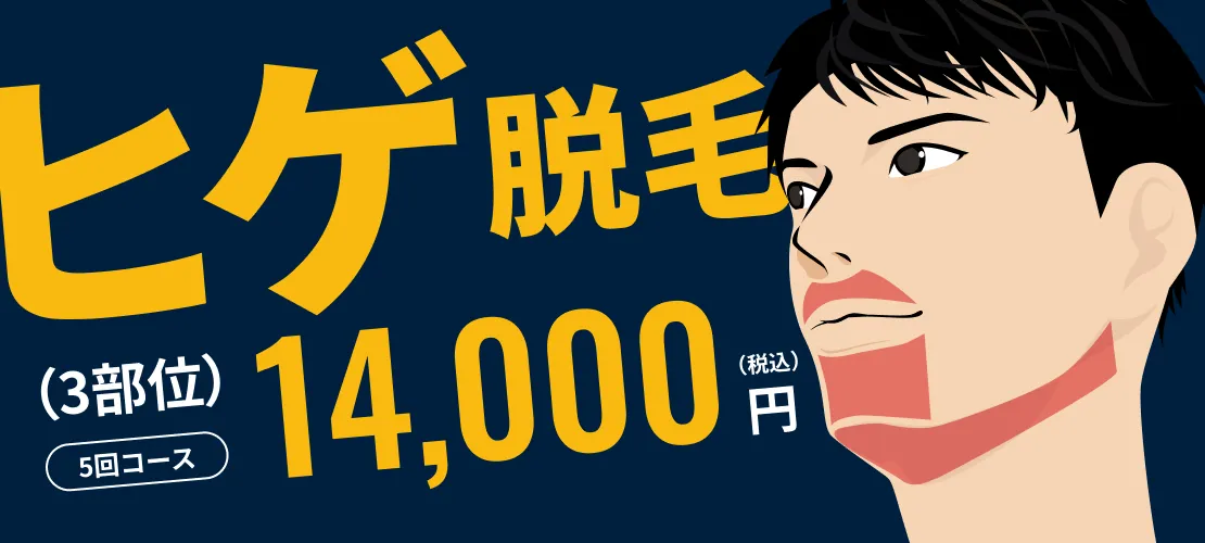 メンズリゼ 大阪