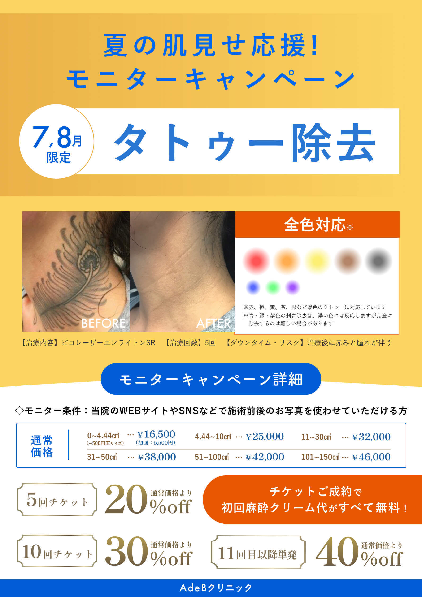 秋田院_7,8月CP_タトゥーモニター_260626